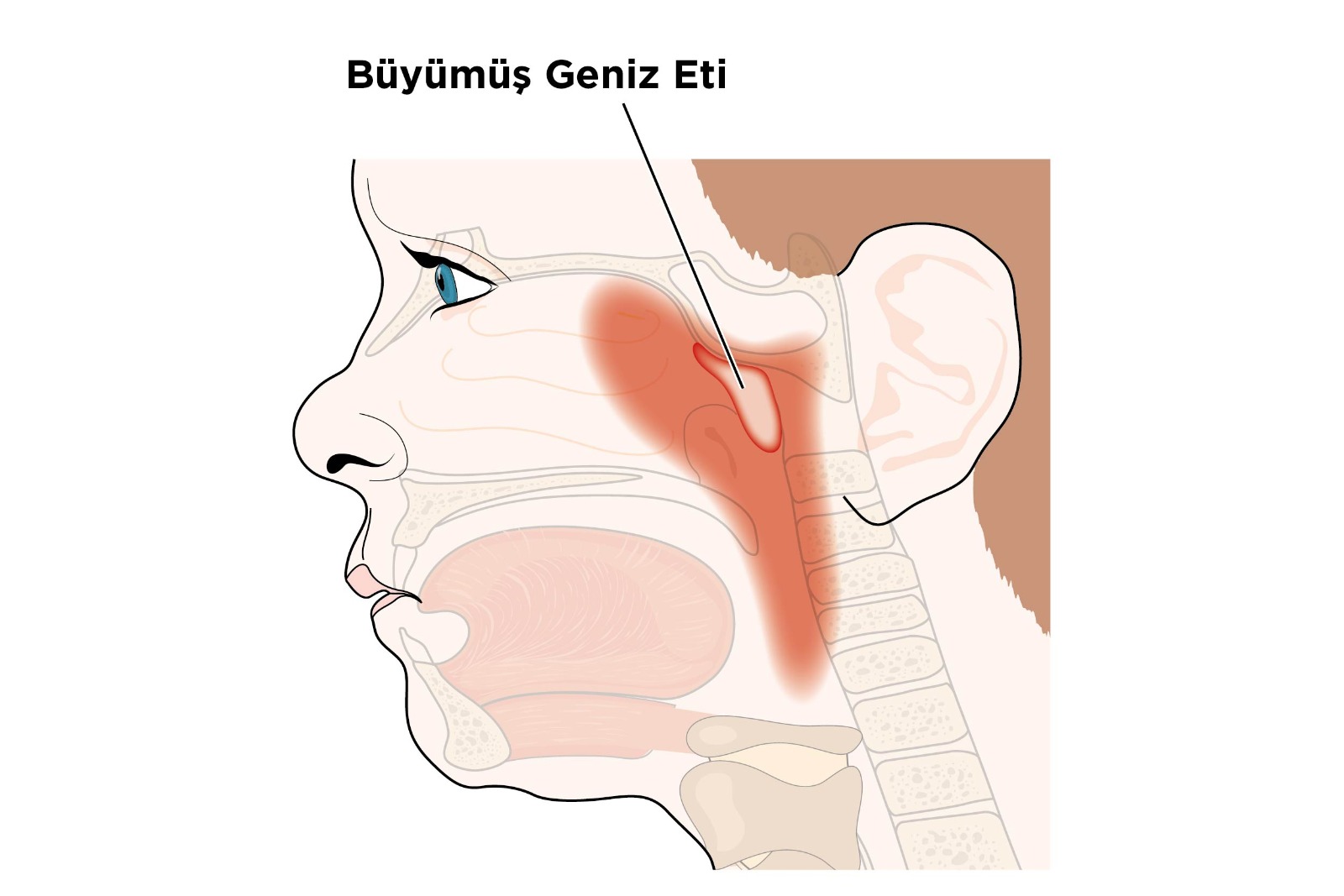 Geniz Eti Bymesi ve Bademcik Bymesi ocuklarn renme Geliimini Yavalatyor